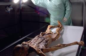 Een onderzoeker onderzoekt de overblijfselen van ijsmummie Ötzi