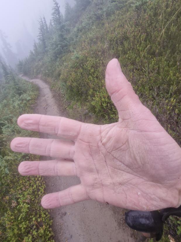 Door de luchtvochtigheid gerimpelde handen